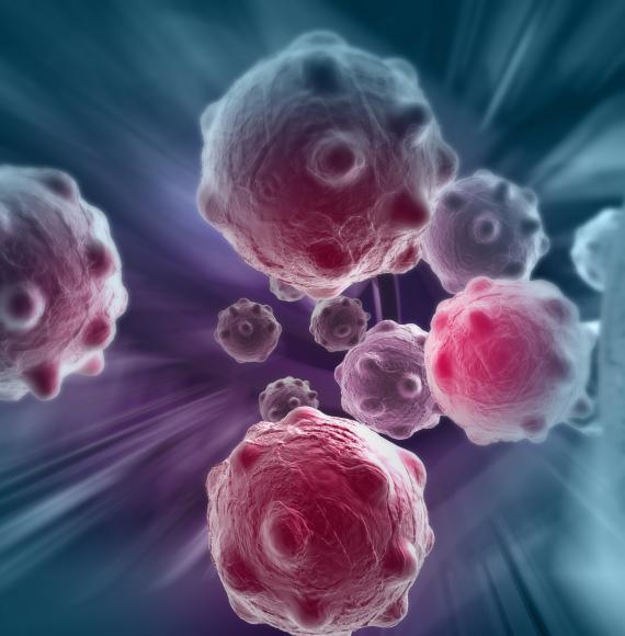 Artist impression of cancer cells
