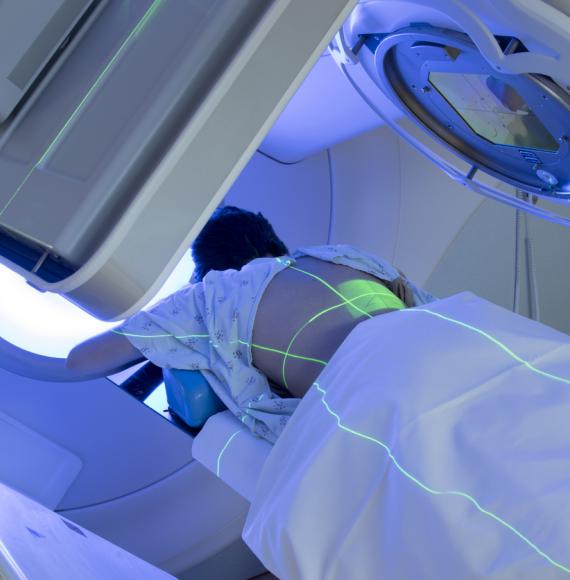 Patient receiving radiotherapy treatment for cancer