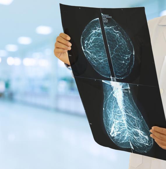 Clinician holding mammogram