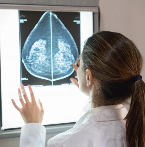 Mammography scanning  - Credit Istock 