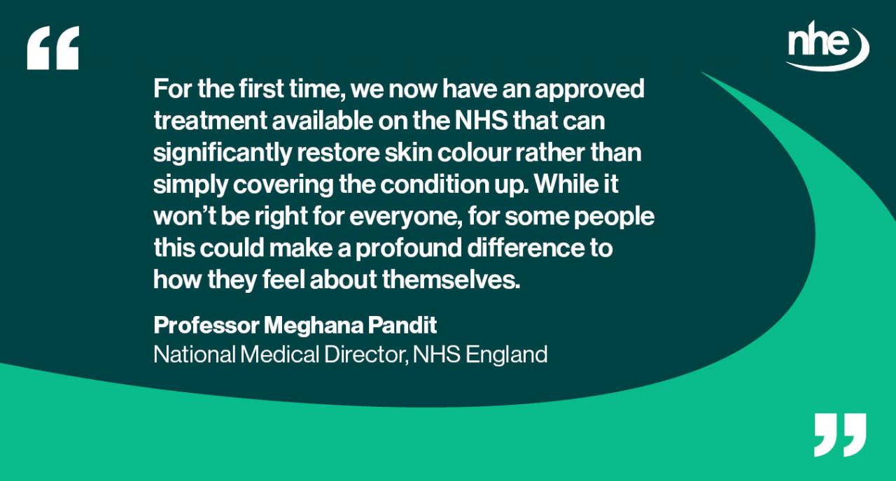 Vitiligo treatment QUOTE