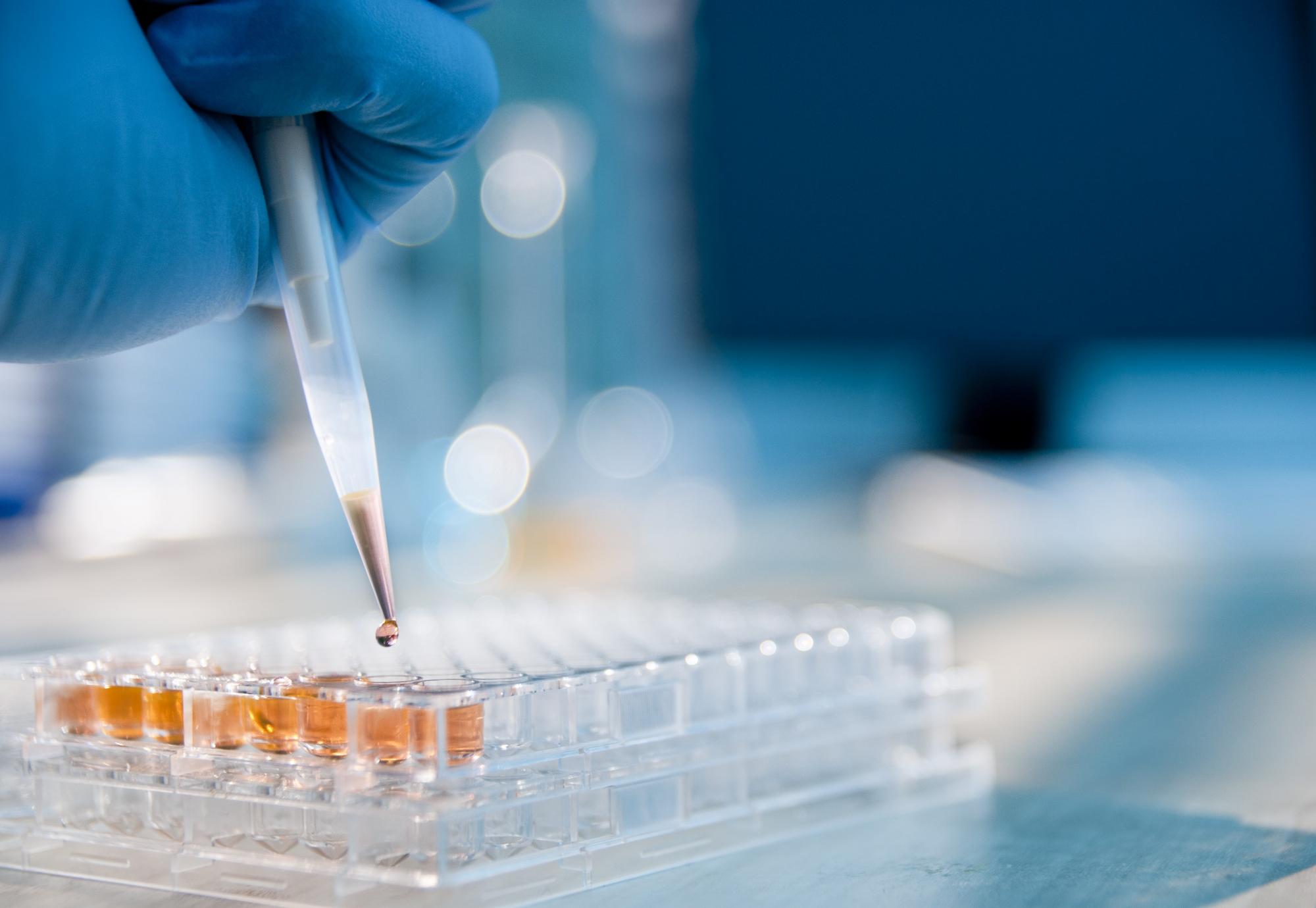 Pipette dropping medicine into lab equipment