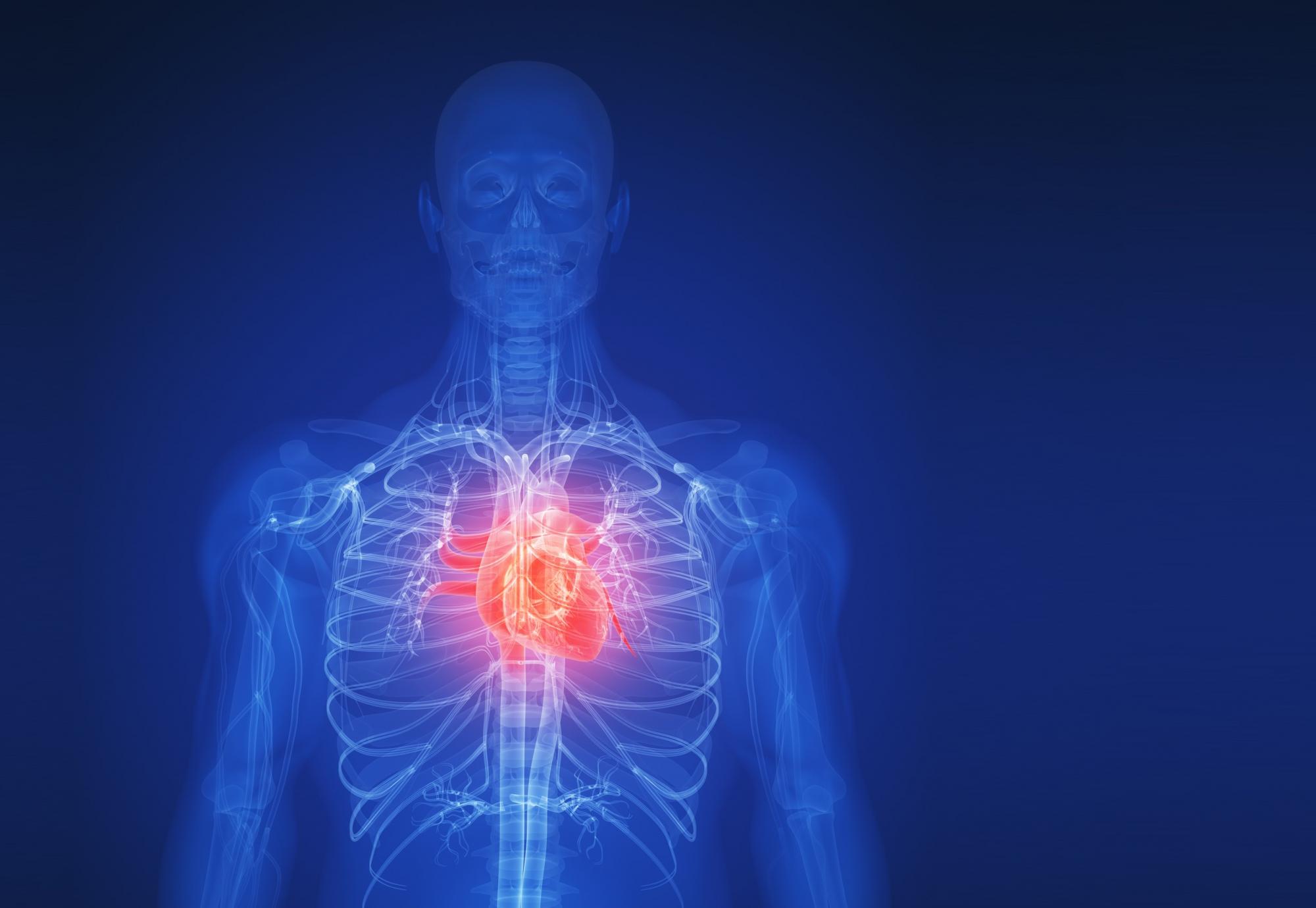 Wireframe illustration of the human body with the heart highlighted