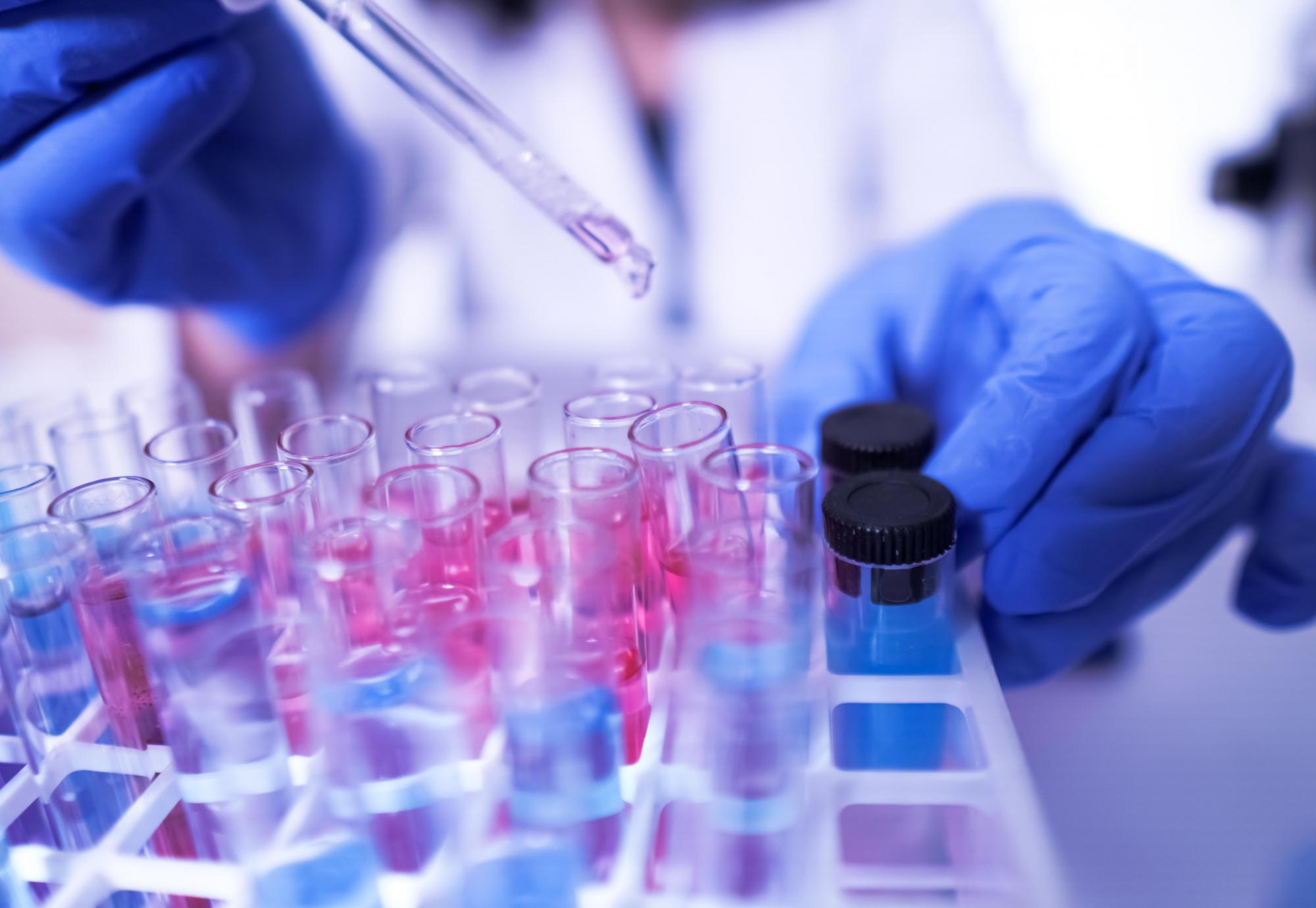 Lab technician using pipette and test tubes