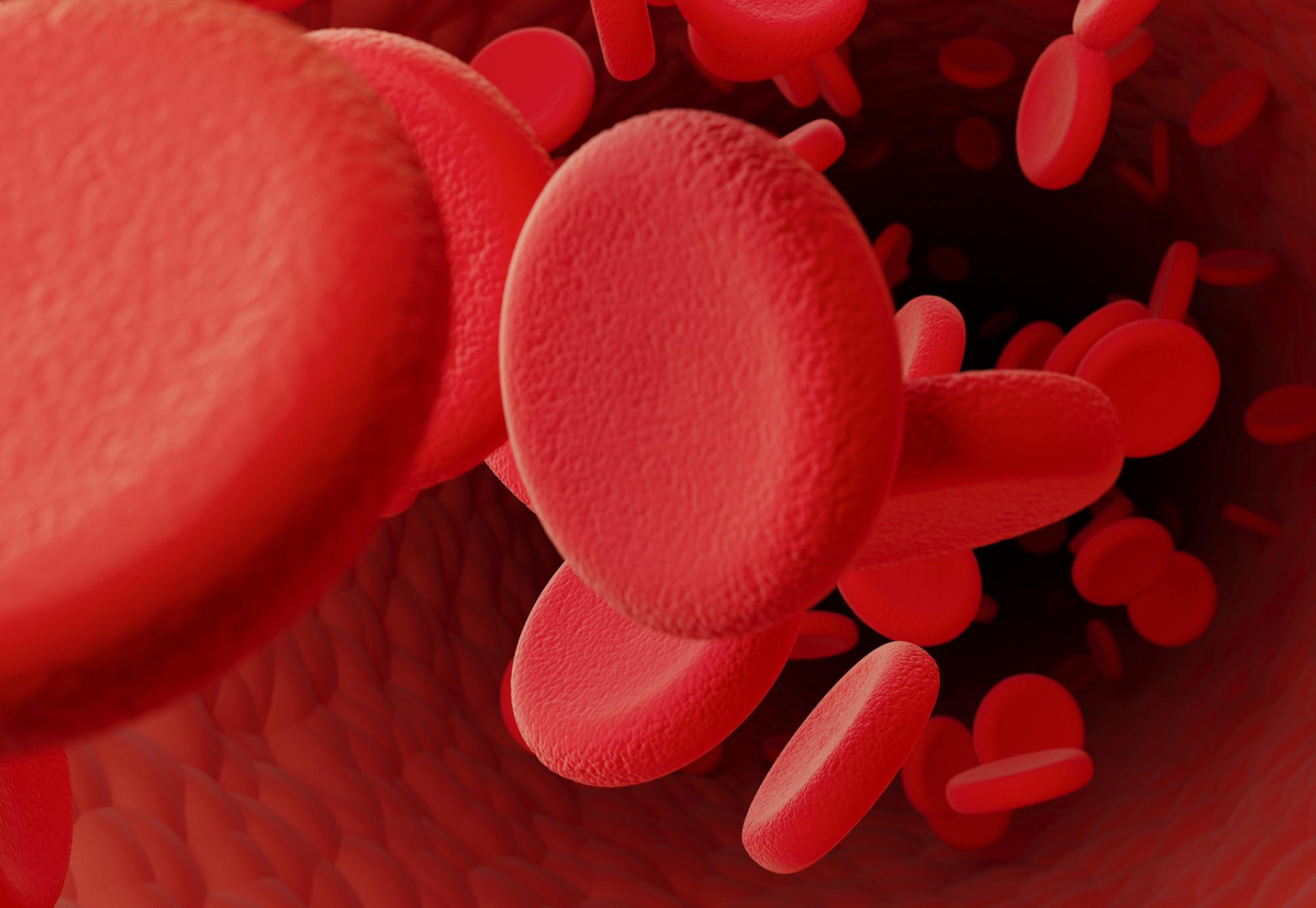 Artist illustration of a blood clot