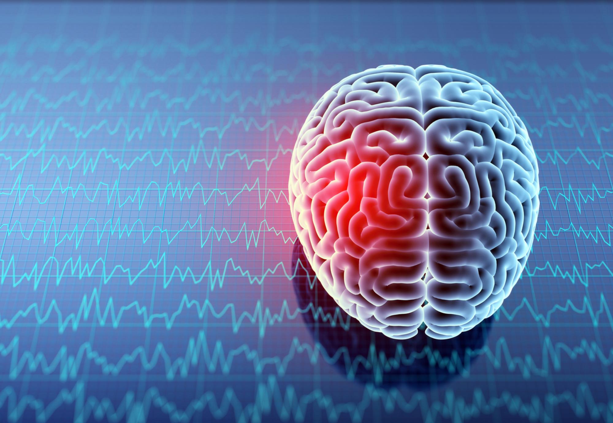 Acquired brain injury patients asked to help develop patient care | UK