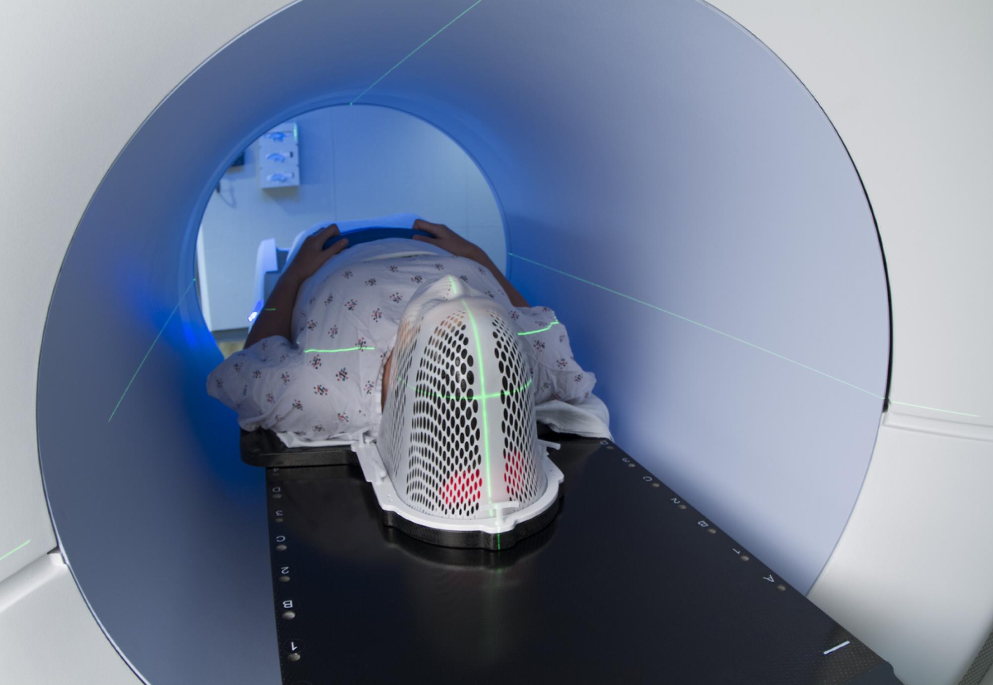 Head and neck cancer scan