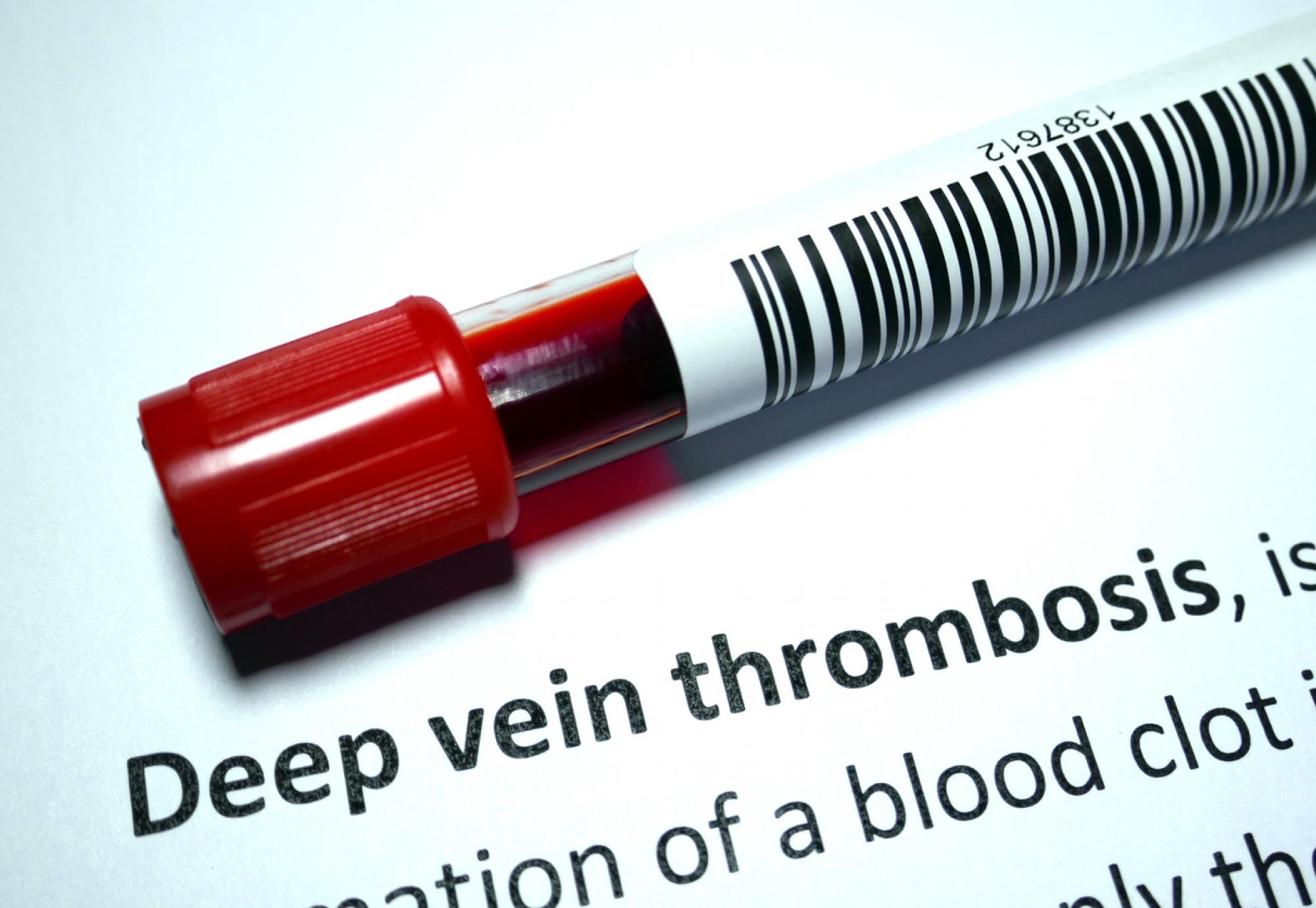 Thrombosis