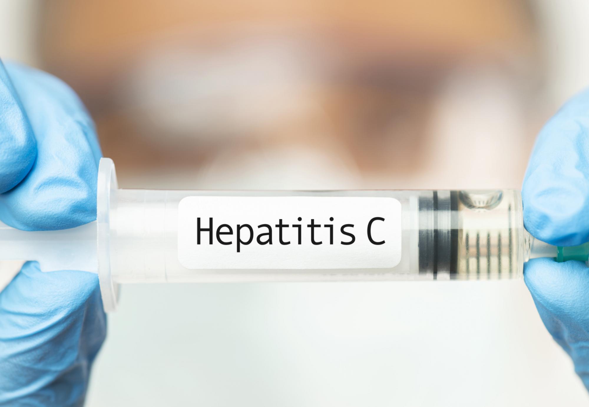 Hepatitis C