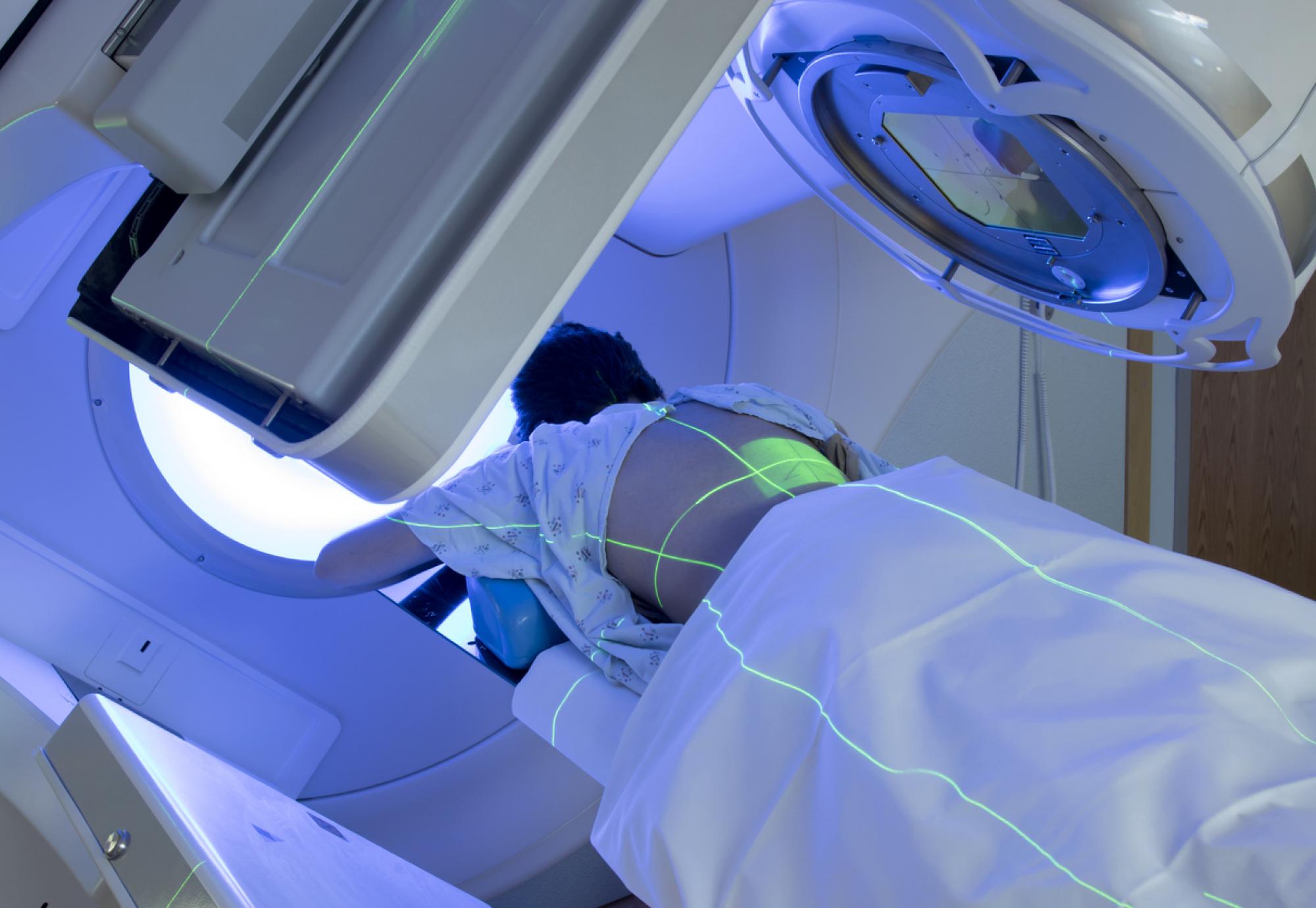 Patient receiving radiotherapy treatment for cancer