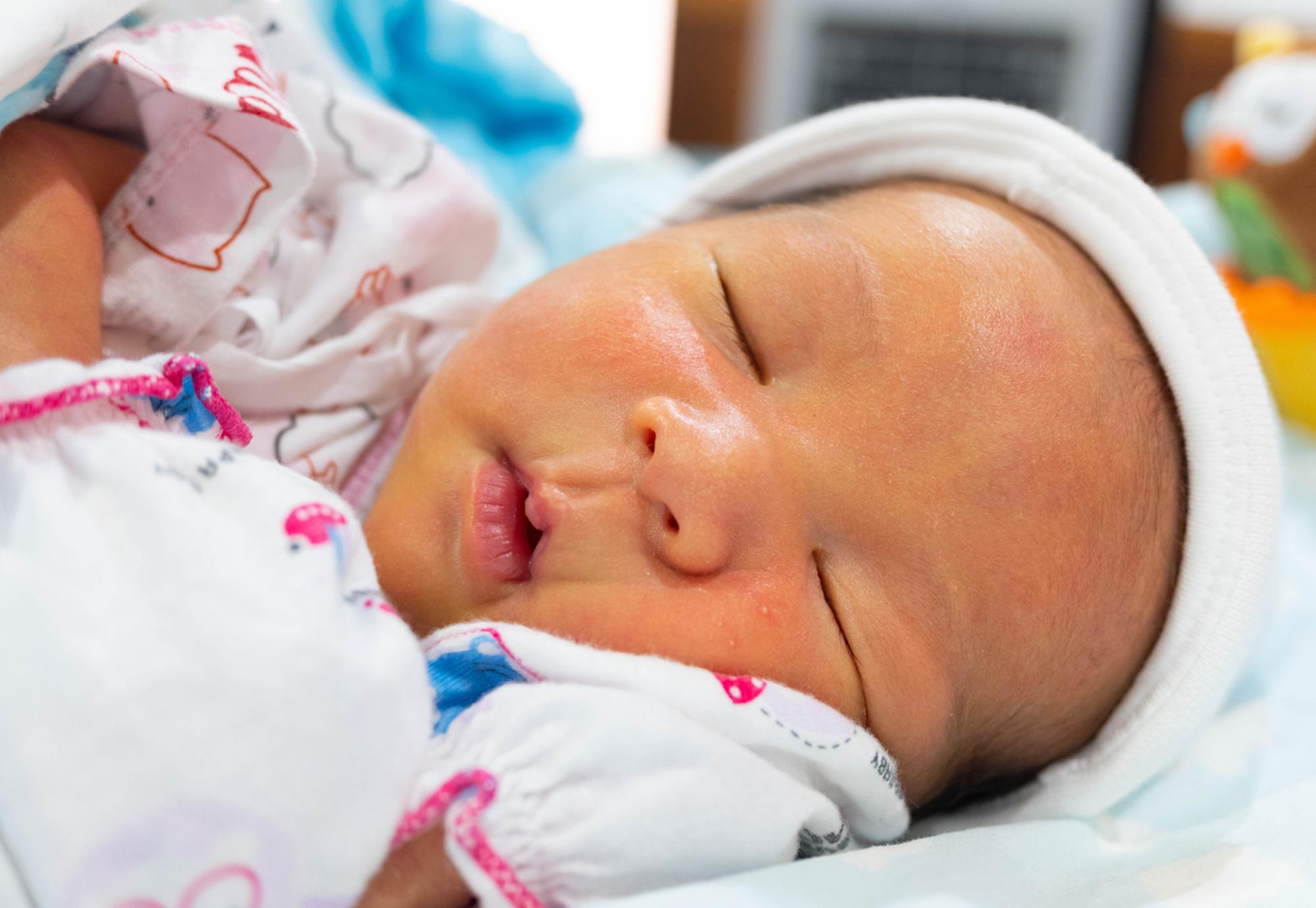 New born baby with jaundice