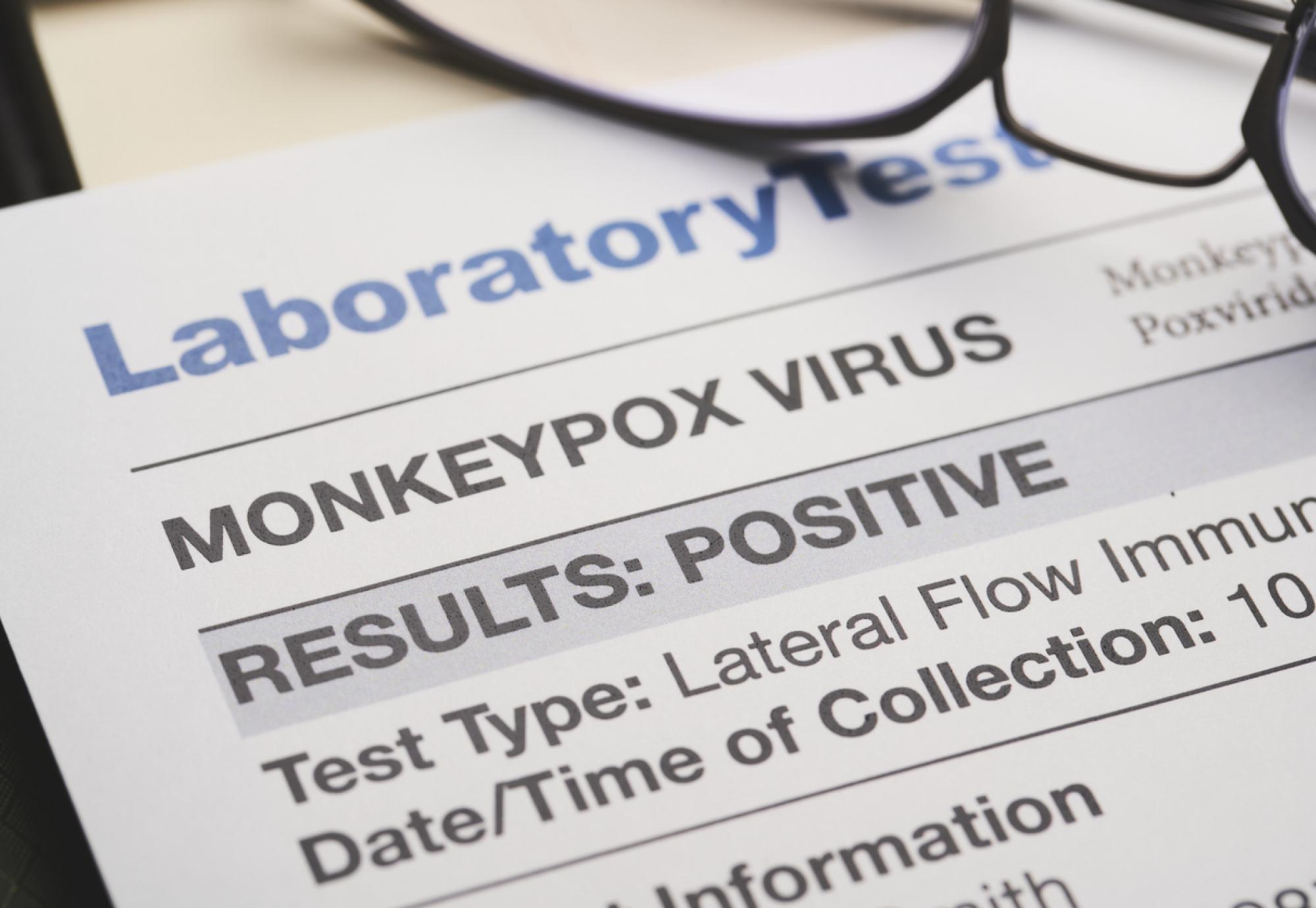 Monkeypox test imag