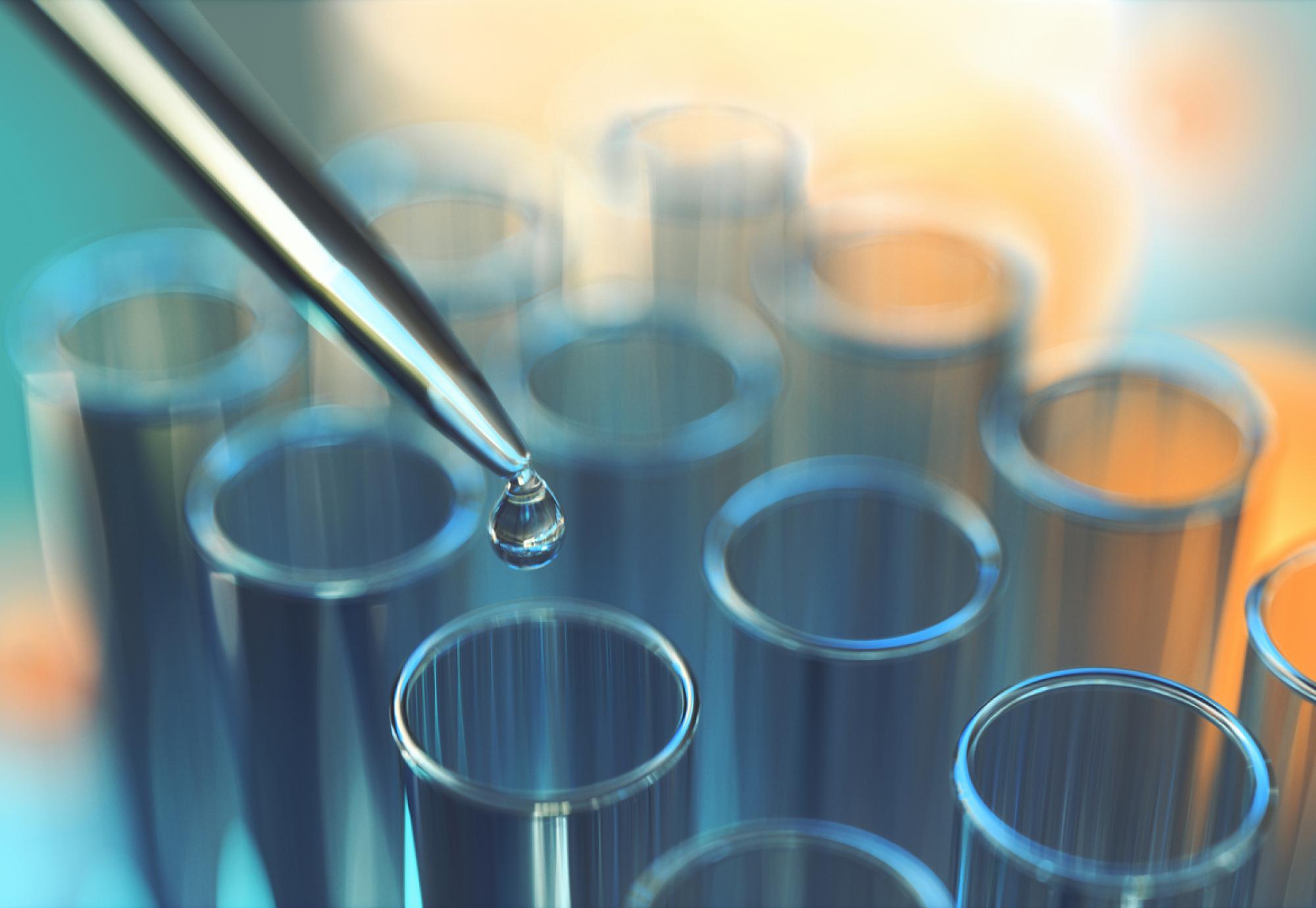 Close-up of beakers in a lab depicting motor neurone disease research