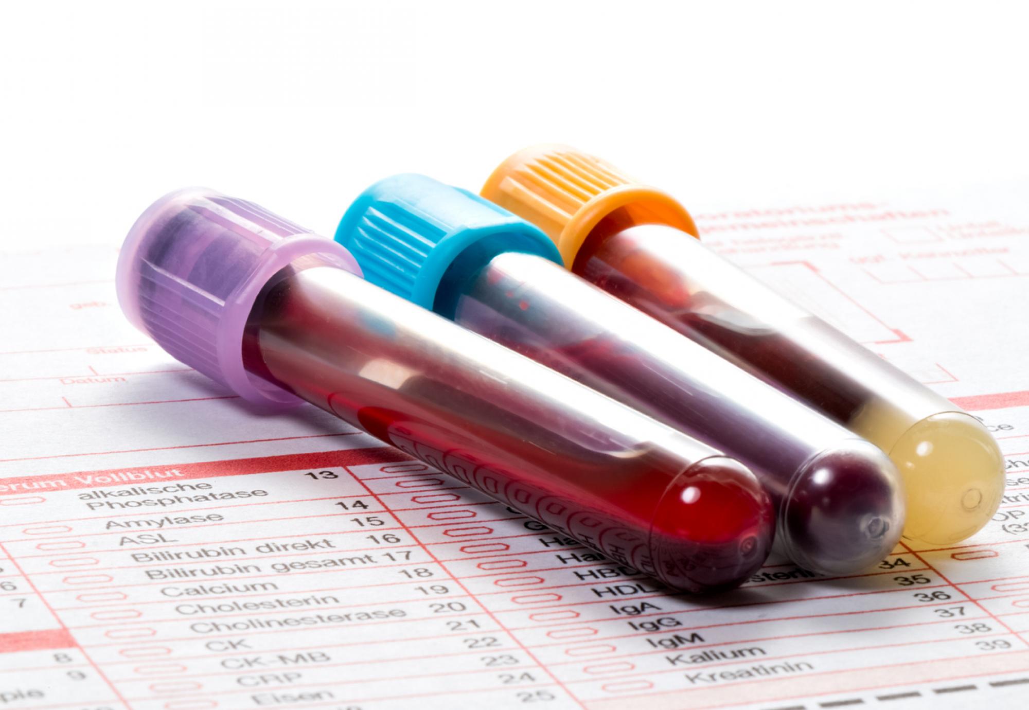 Blood test for Parkinson's disease