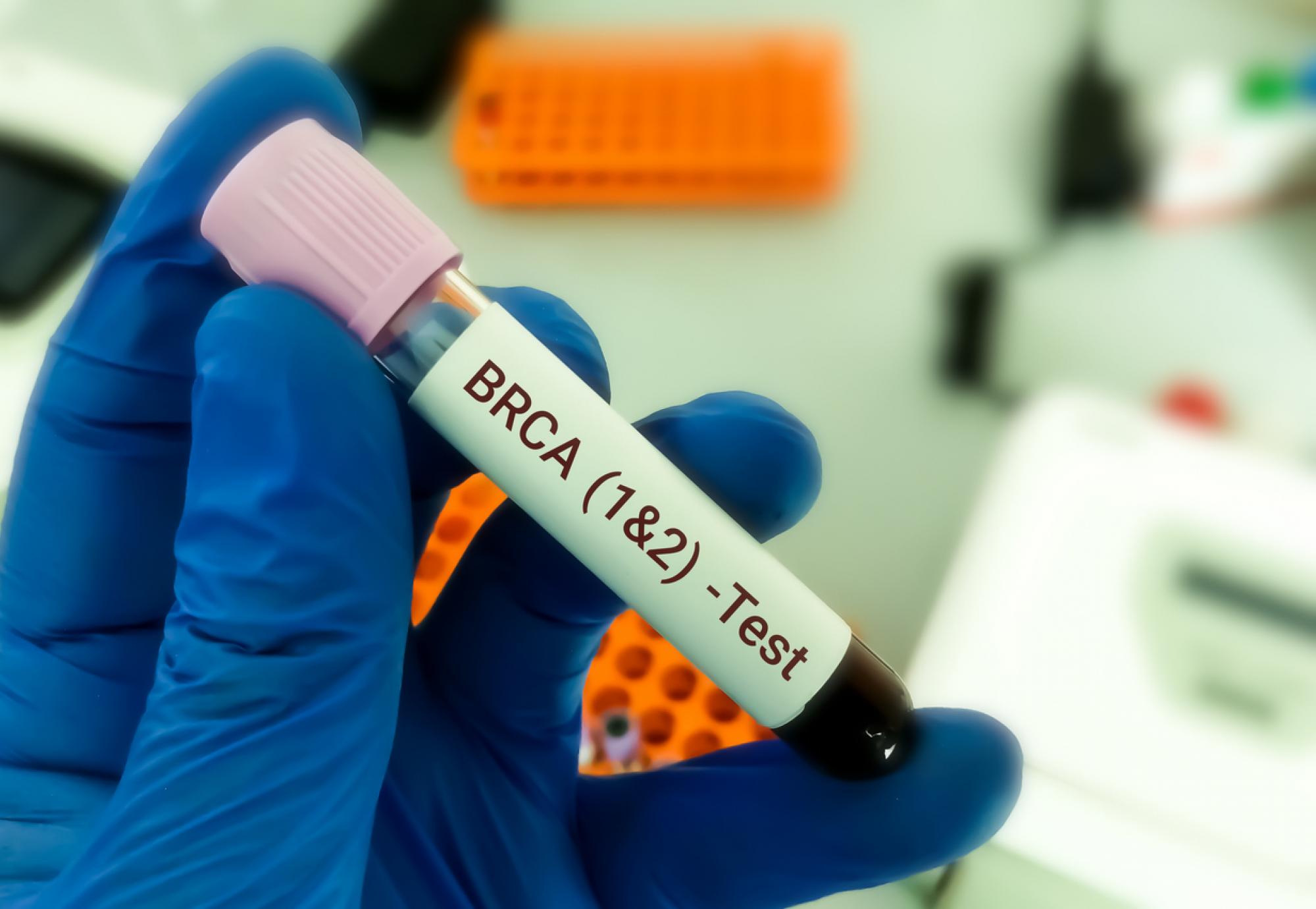 BRCA gene test for cancer