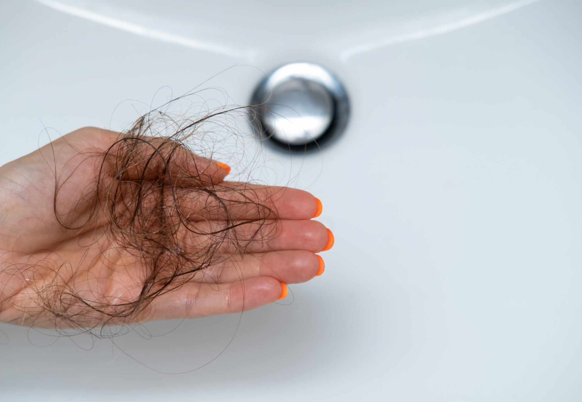 Hair loss from alopecia