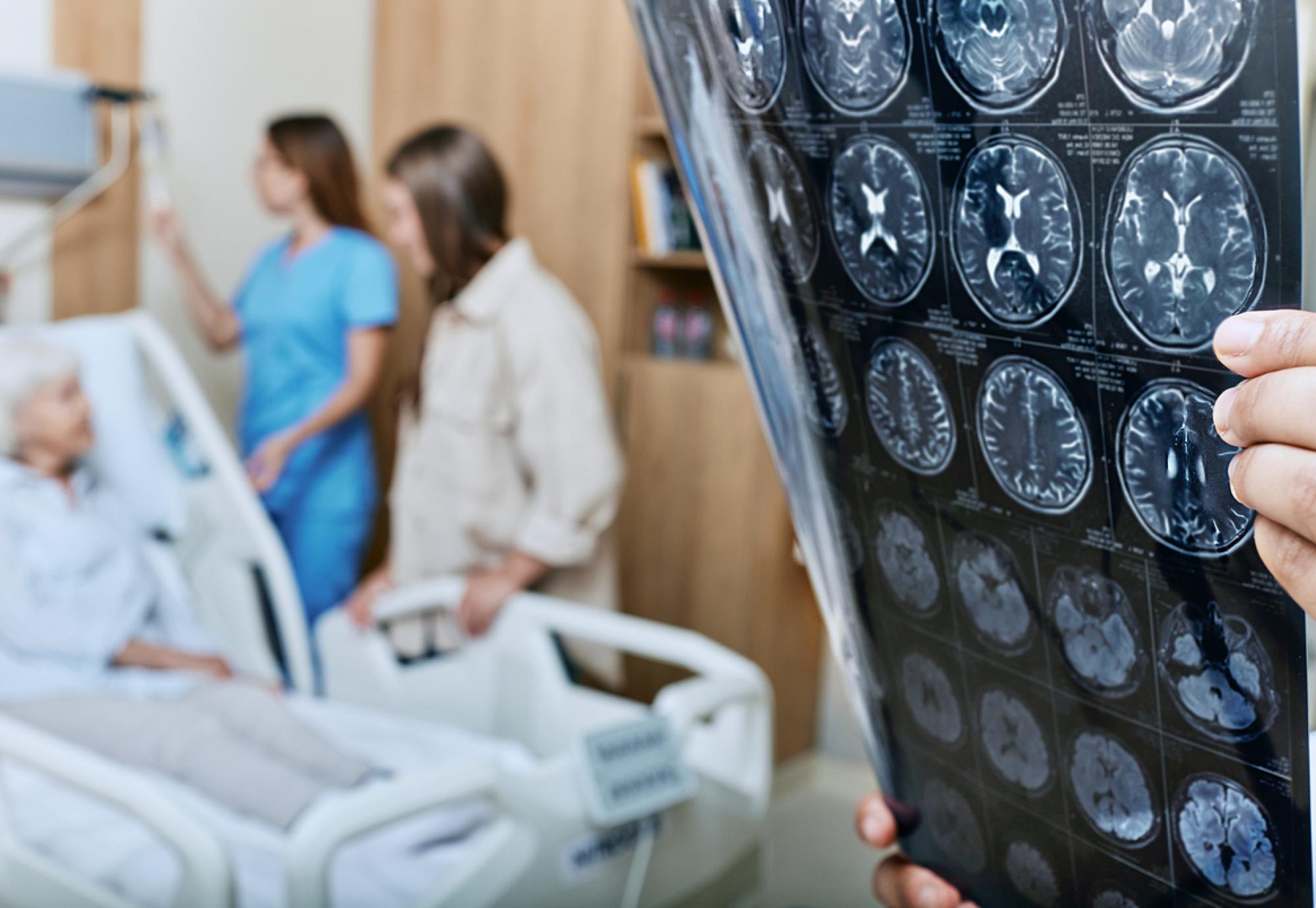 Alzheimer's disease