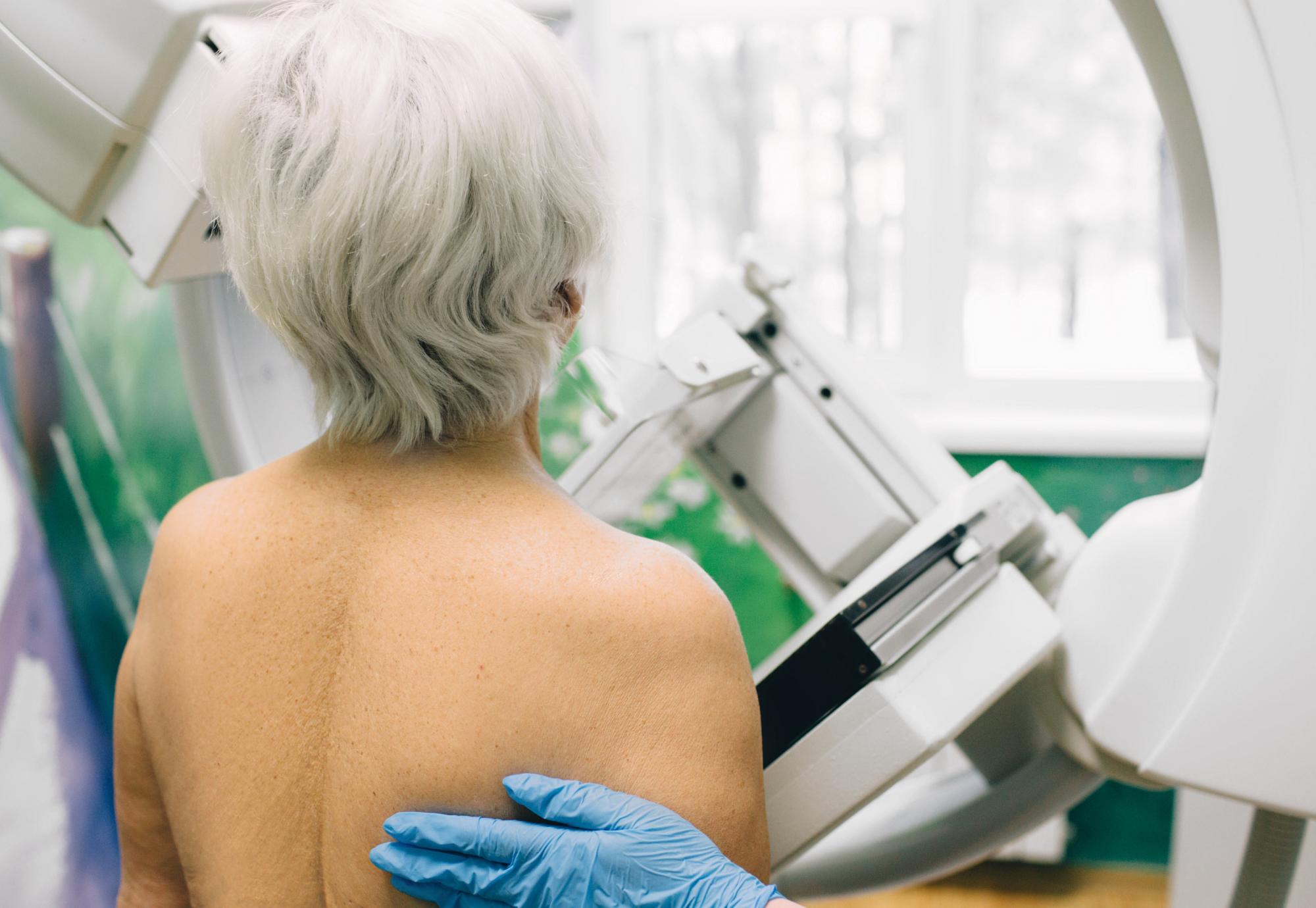 woman having a mammography scan