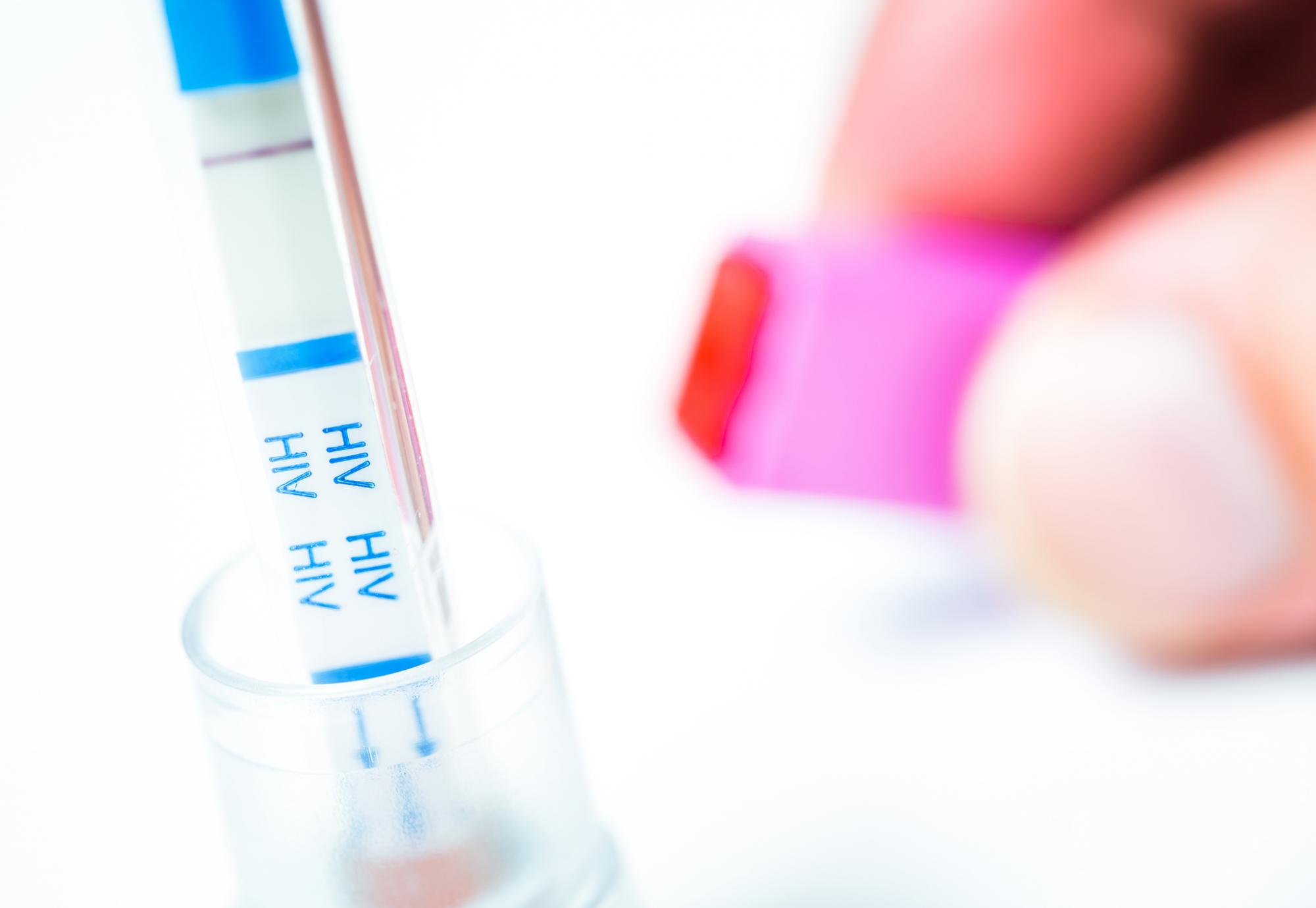 HIV self-test