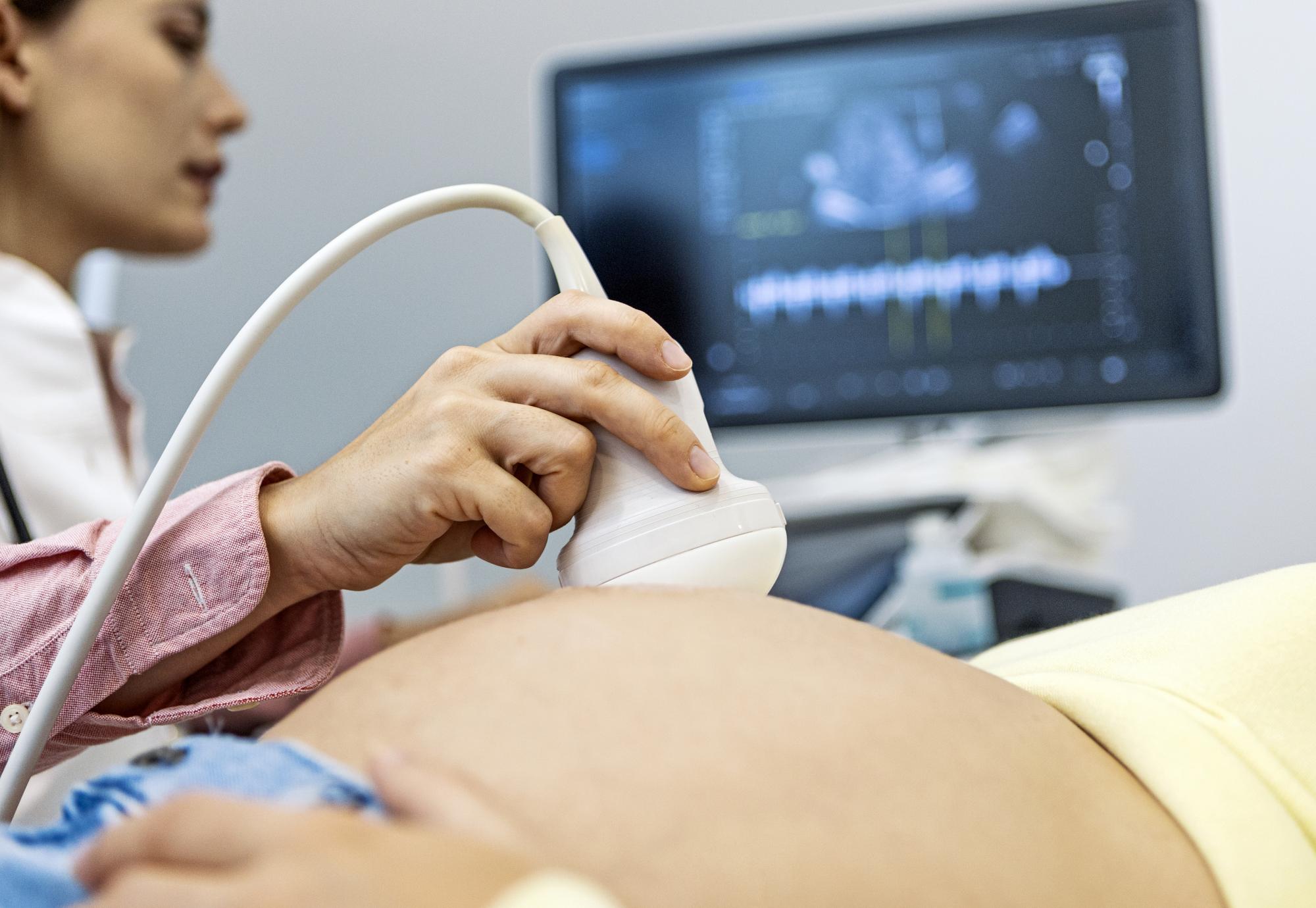 doctor performing ultrasound on a pregnant woman