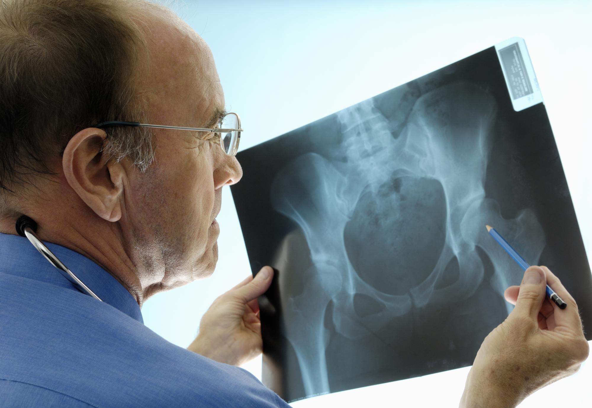 X-ray of someone's bones