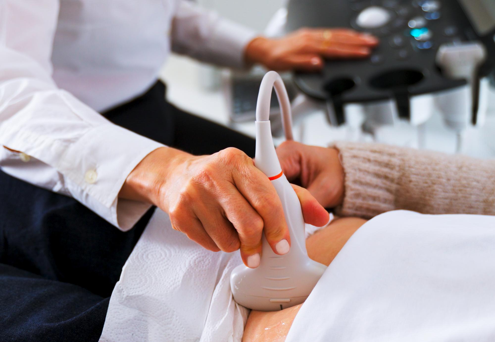 Scan for ovarian cancer