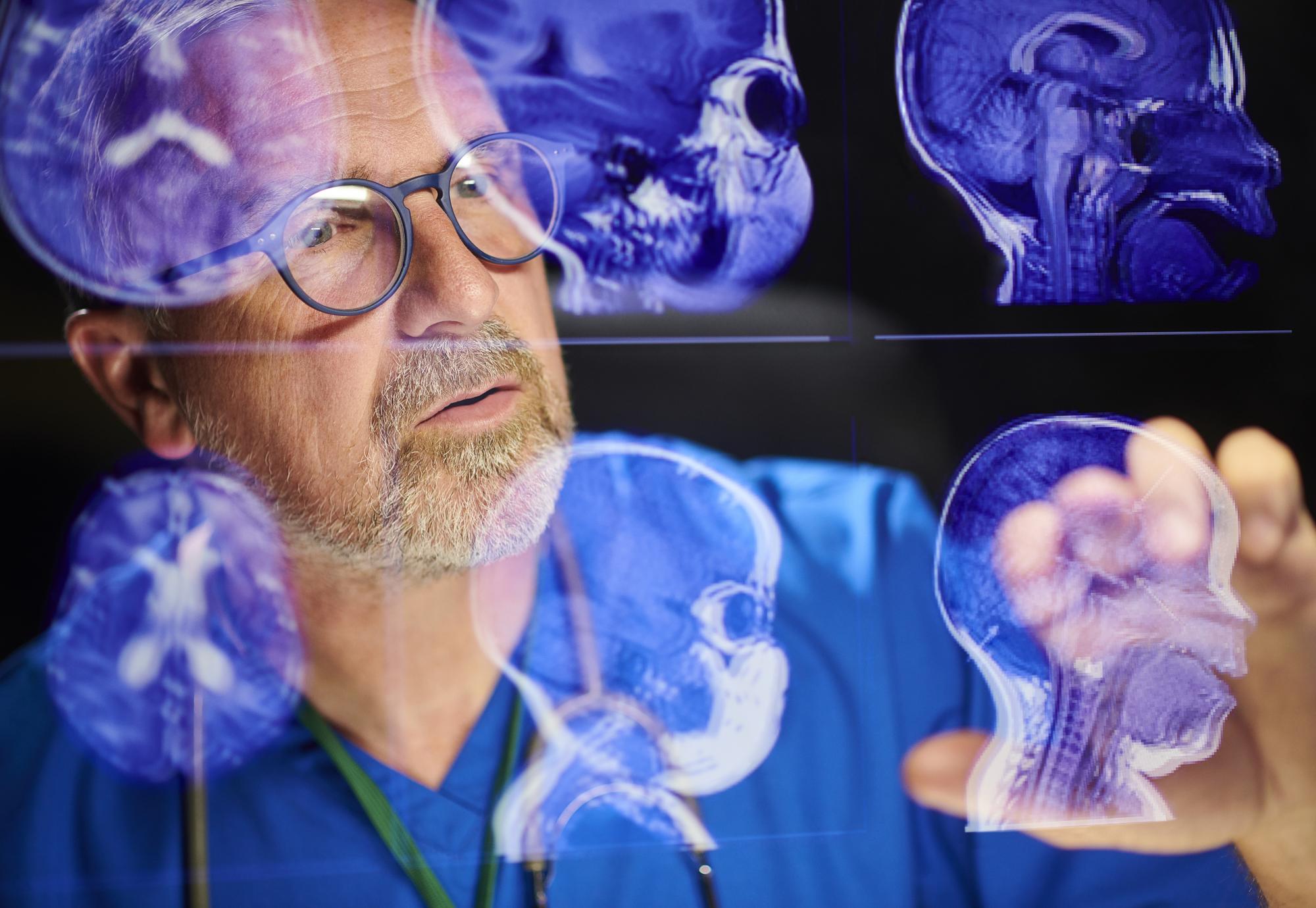 Medical professional looking at brain scans