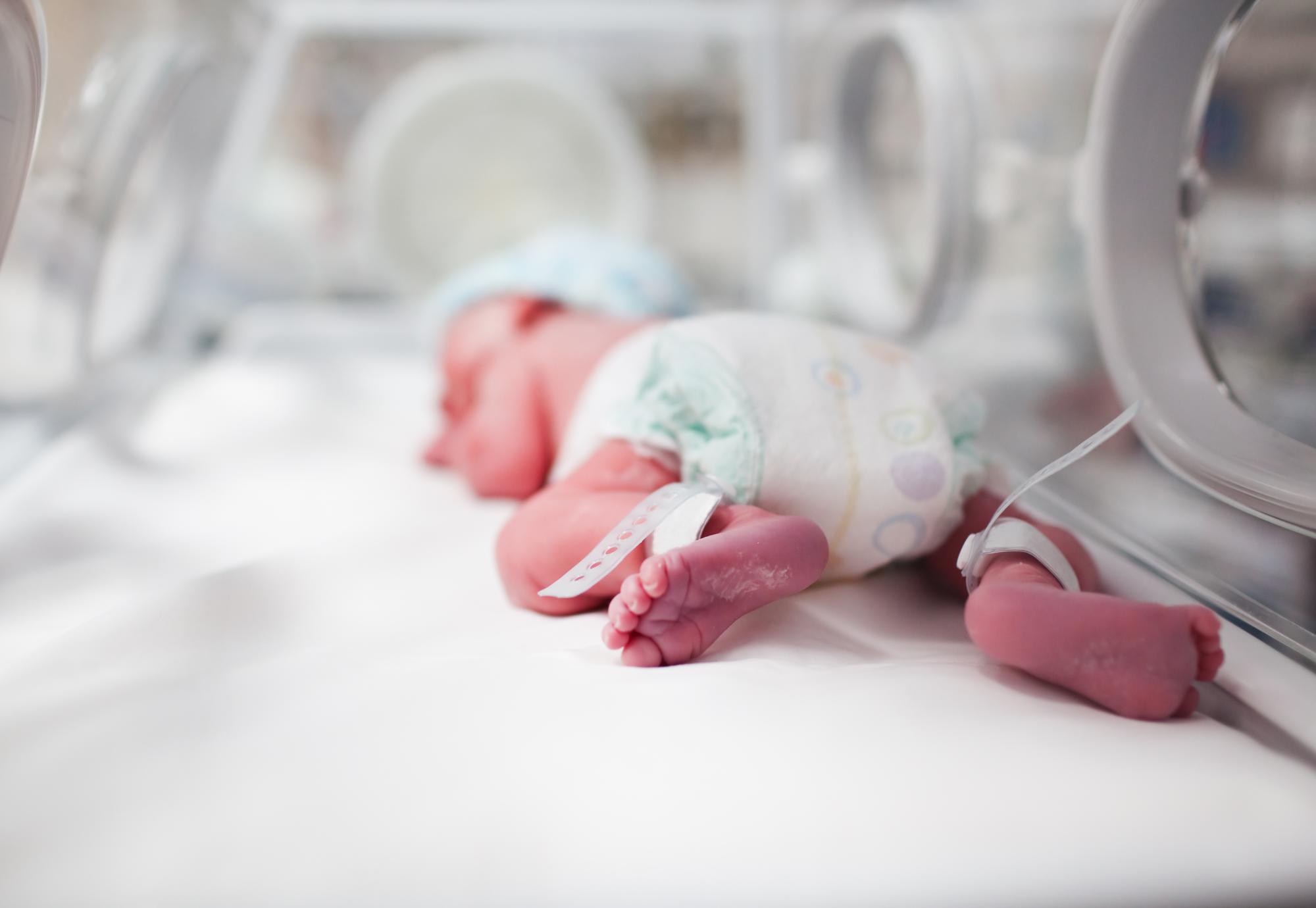 Newborn baby in ICU