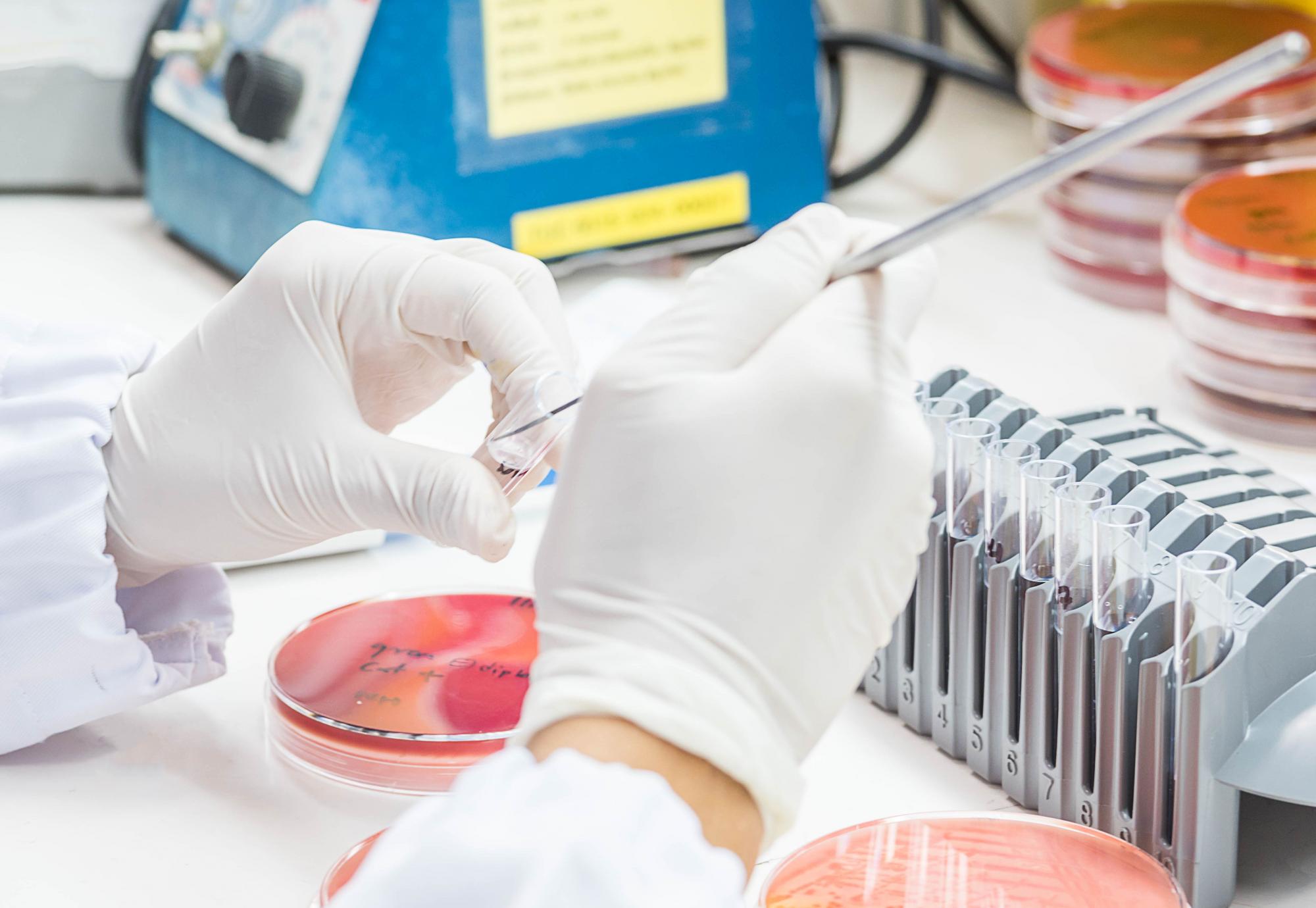 Bacteria culture