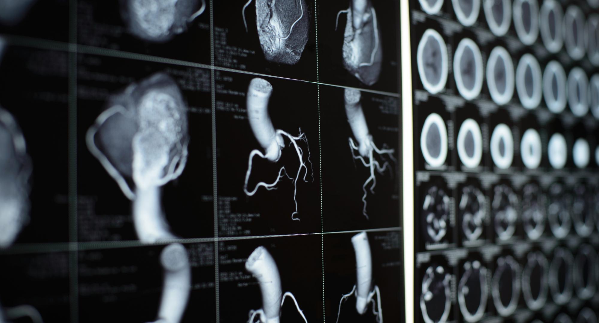 Cardiac CT scan