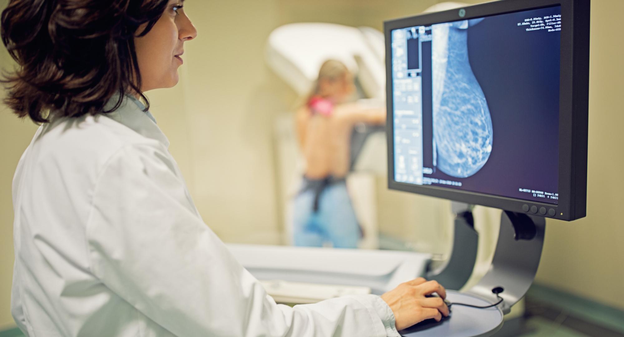 Clinicians looking at mammogram