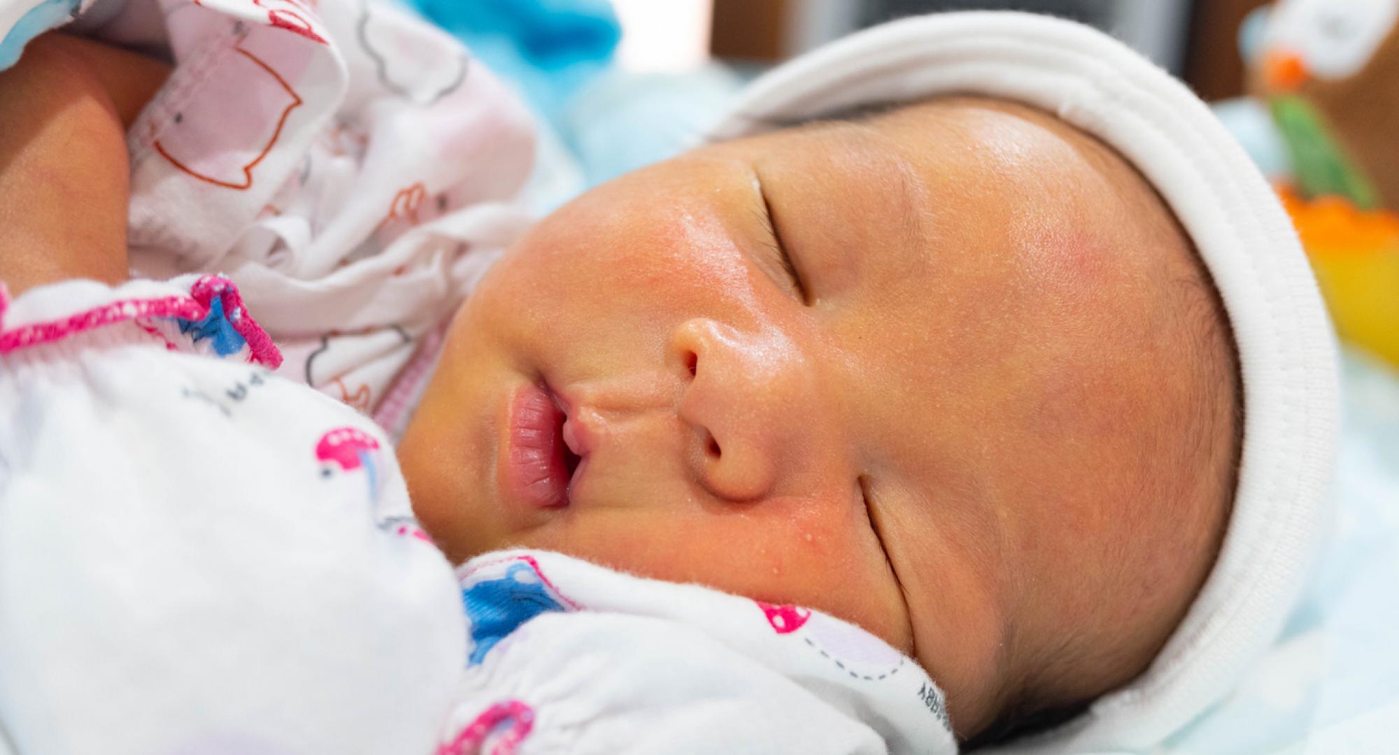 New born baby with jaundice