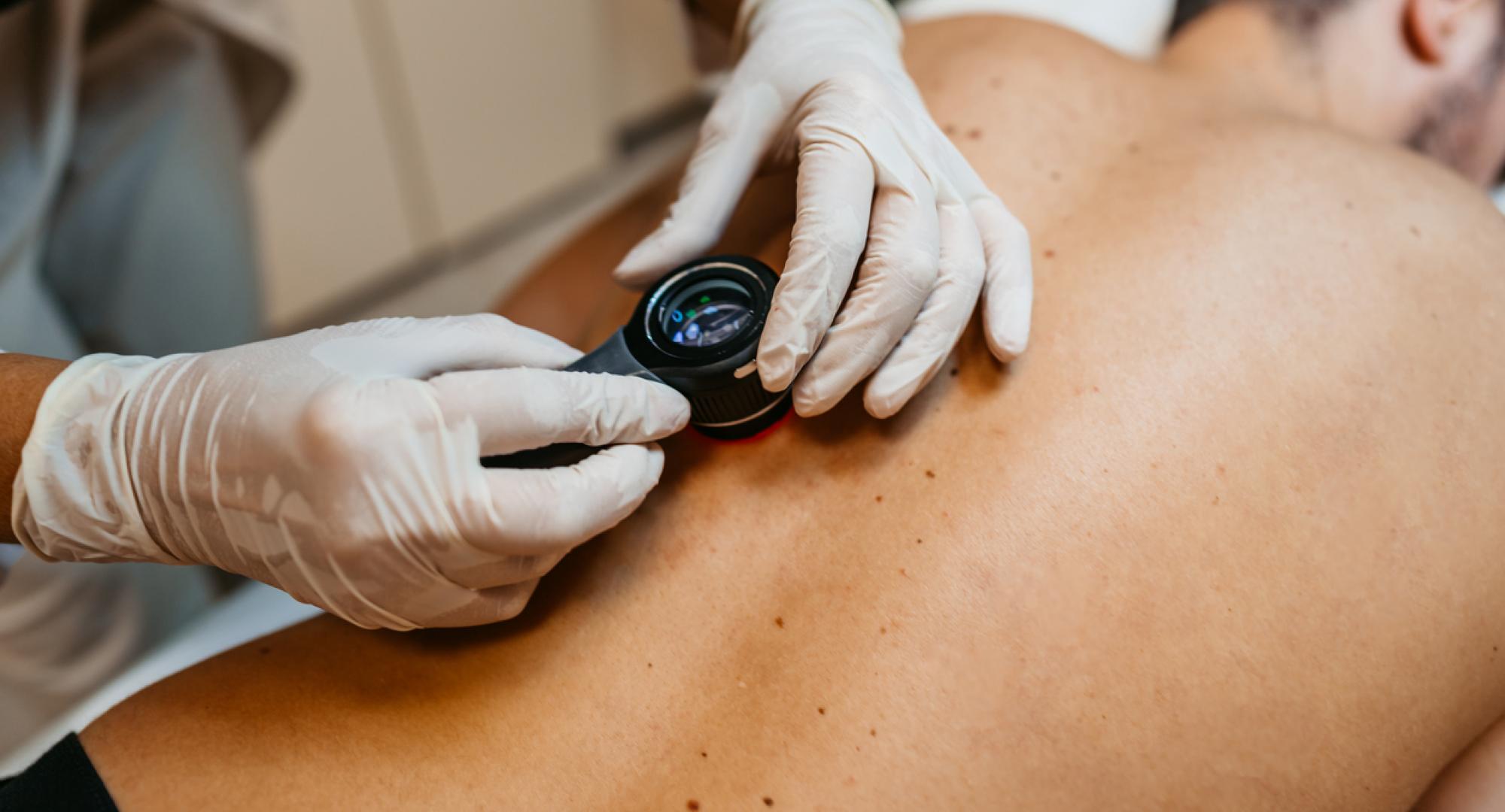 Dermatology