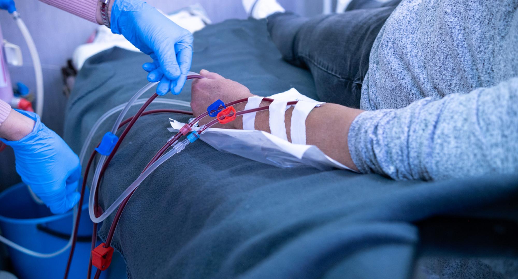 Dialysis