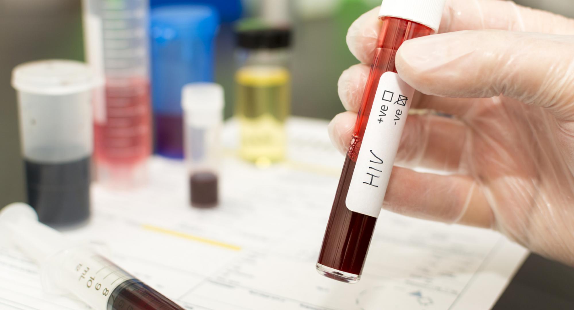 HIV blood test
