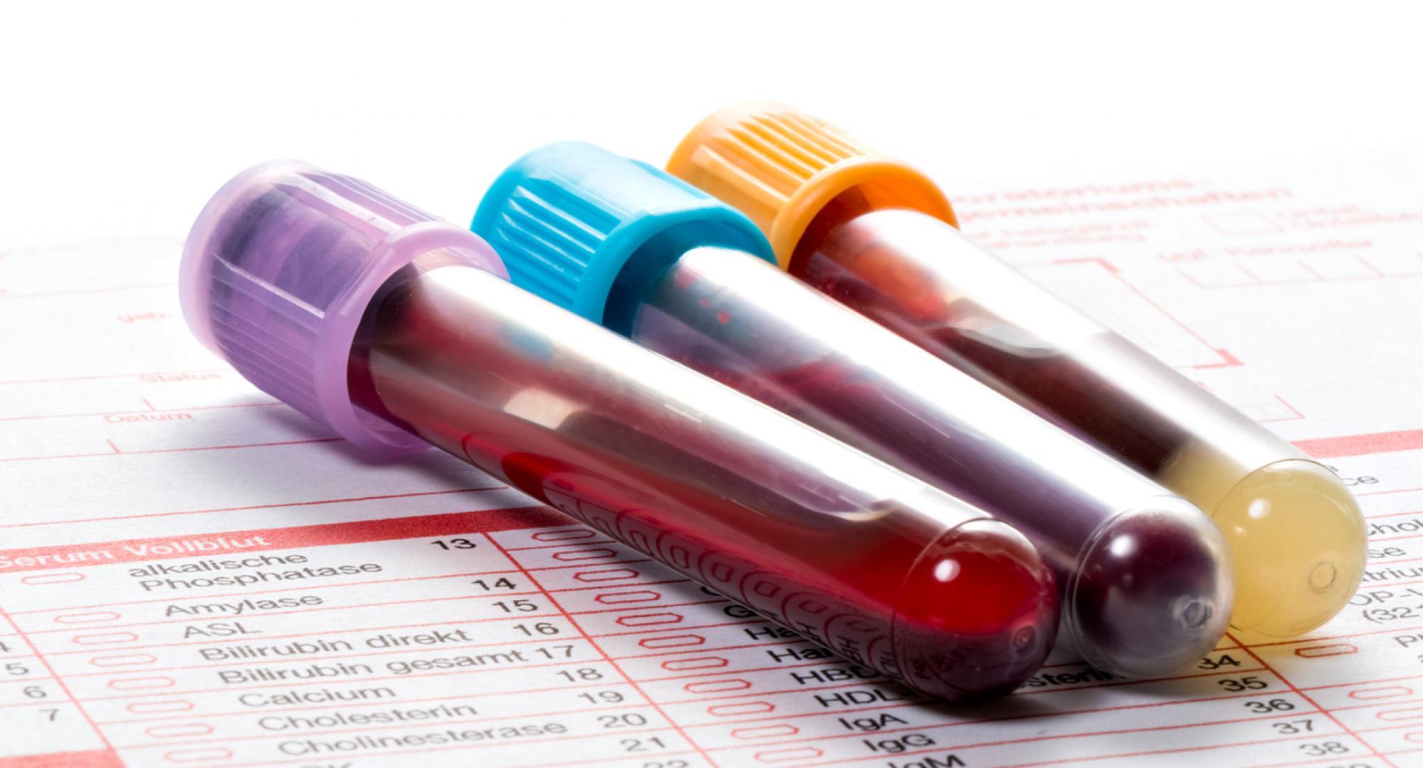 Blood test for Parkinson's disease