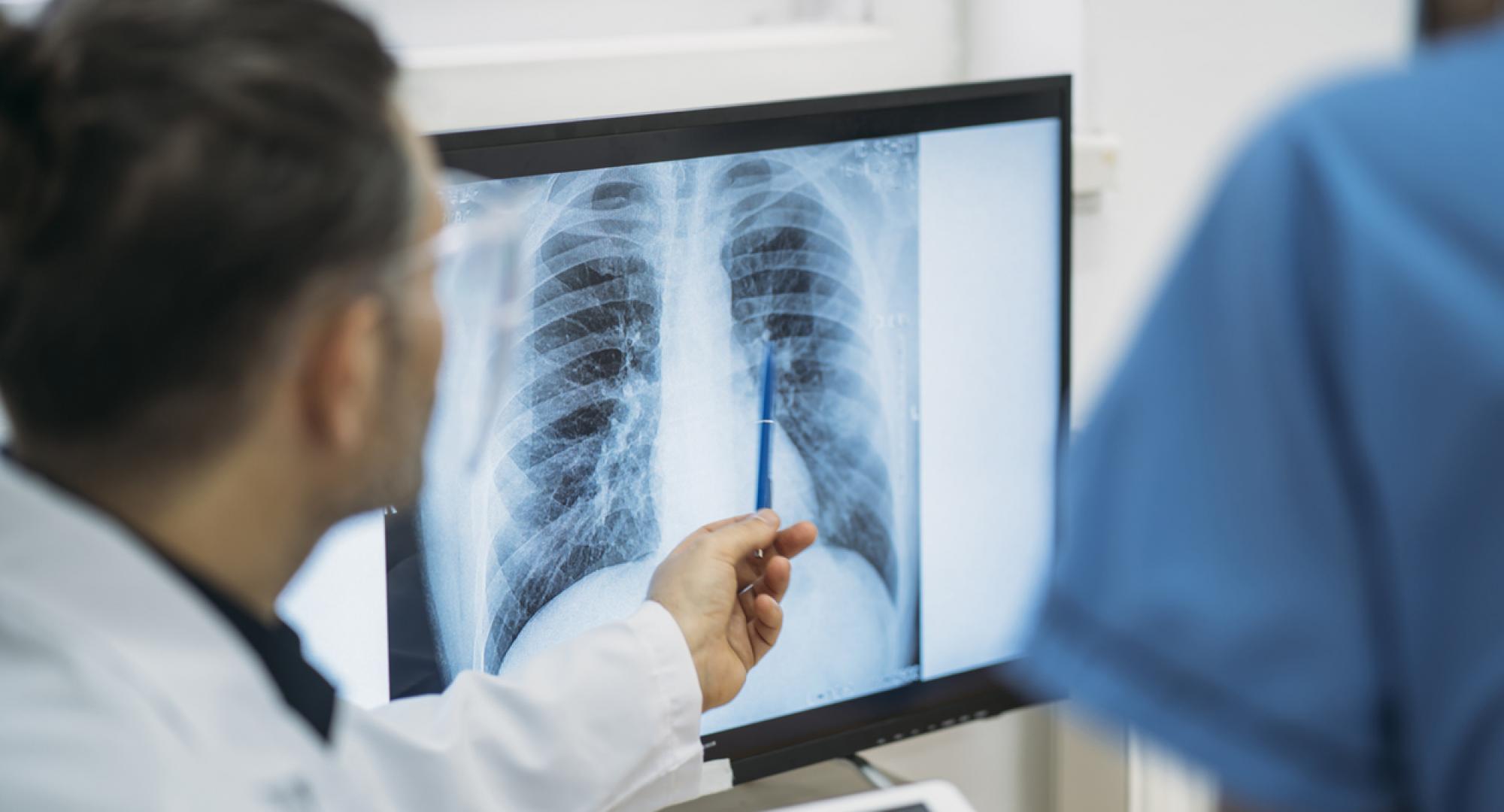 Doctor analysing an x-ray