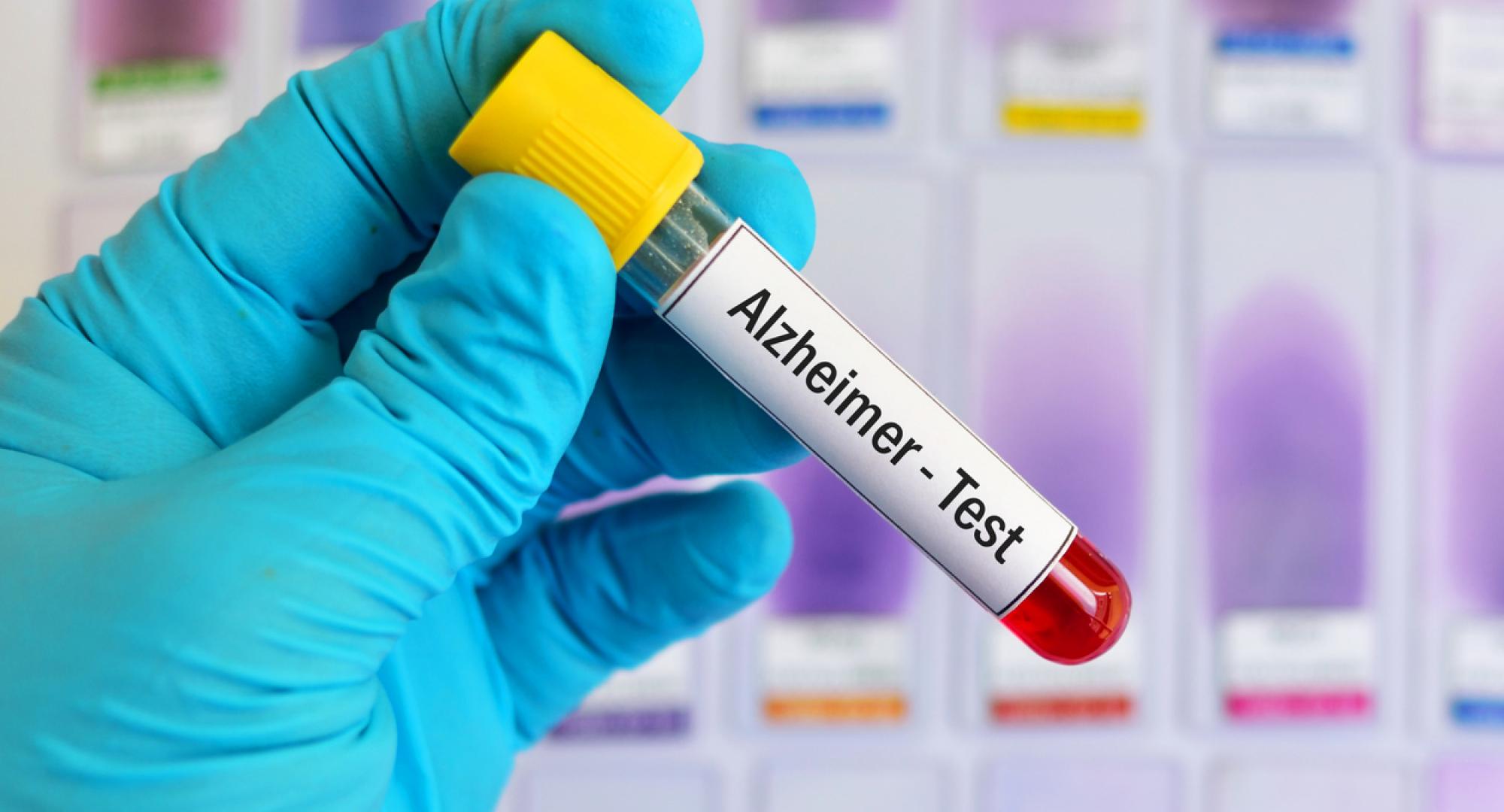 Blood test for Alzheimer's disease