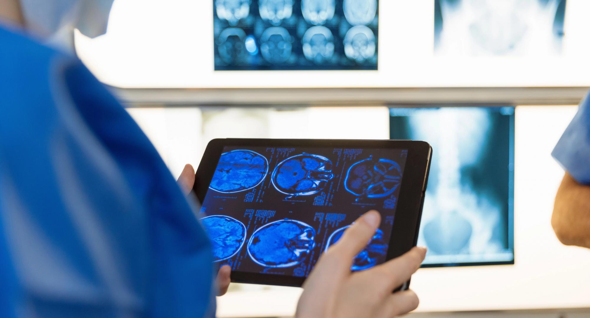 Doctor examining x-ray