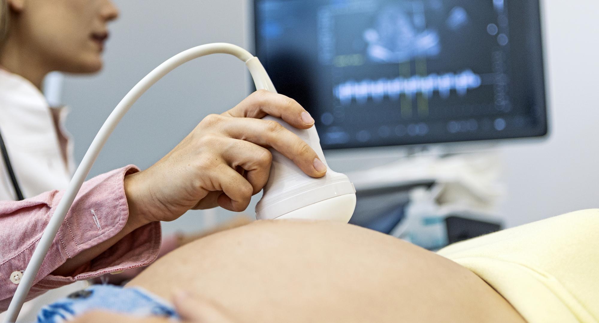 Maternity scan