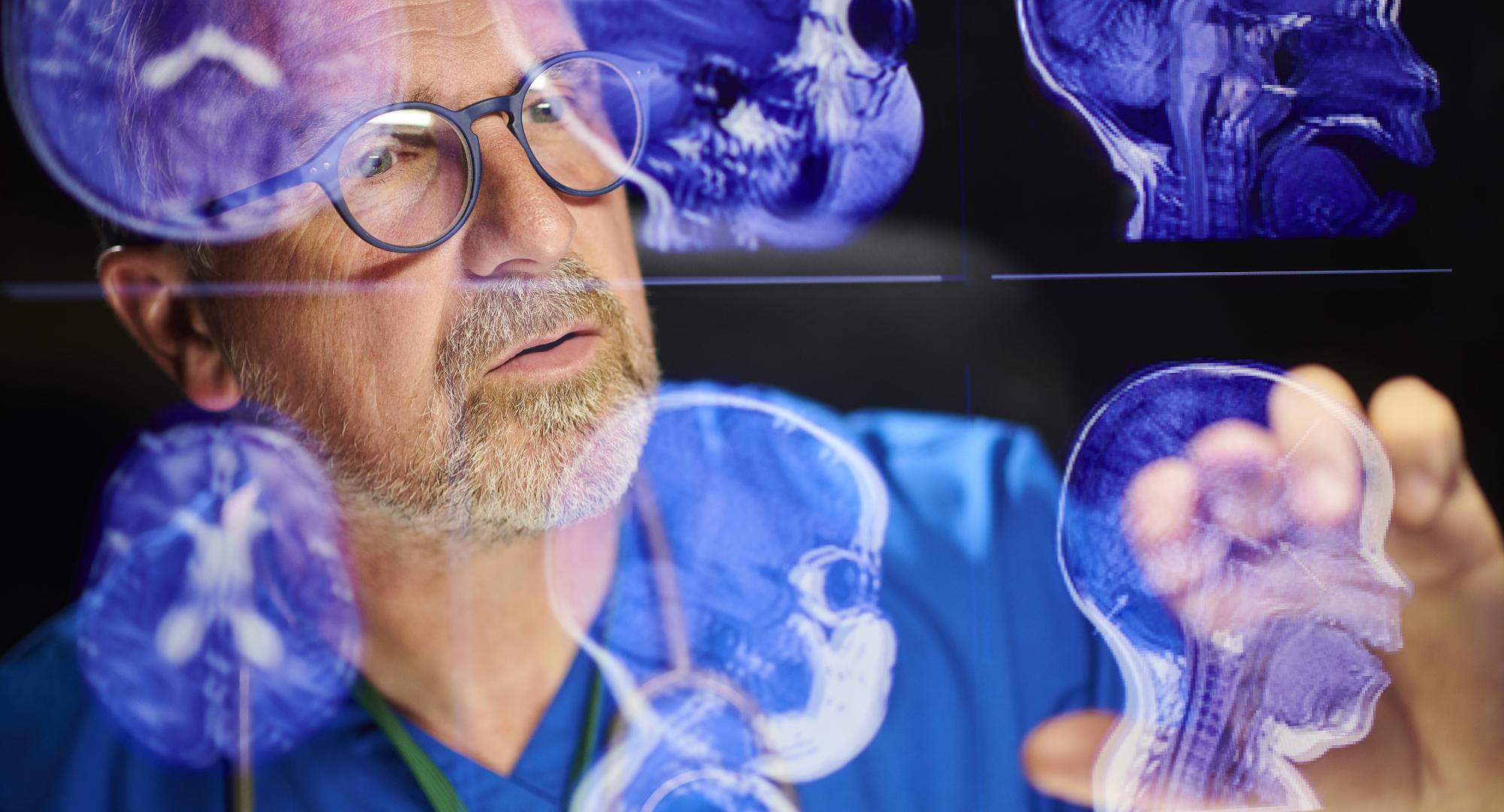 Analysing brain scans