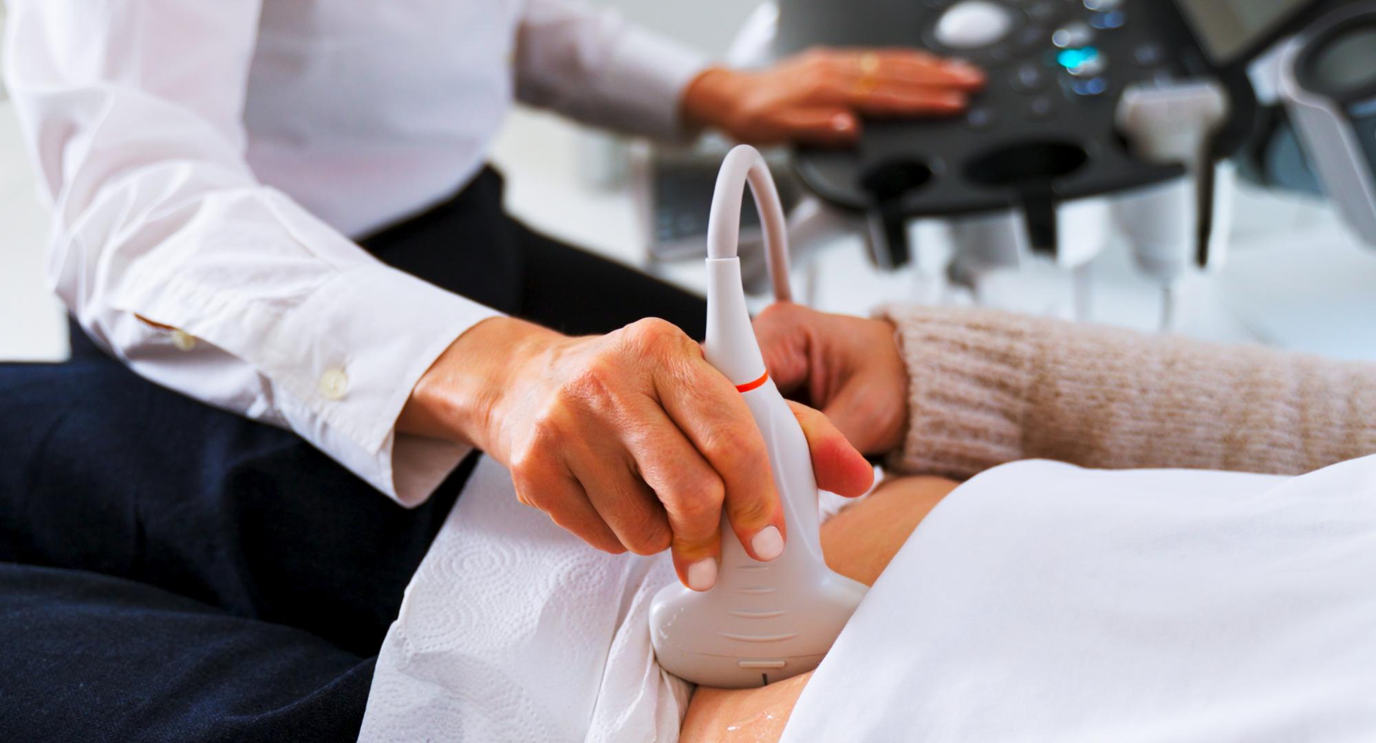 Scan for ovarian cancer