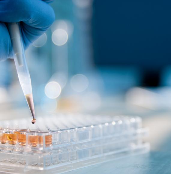 Pipette dropping medicine into lab equipment