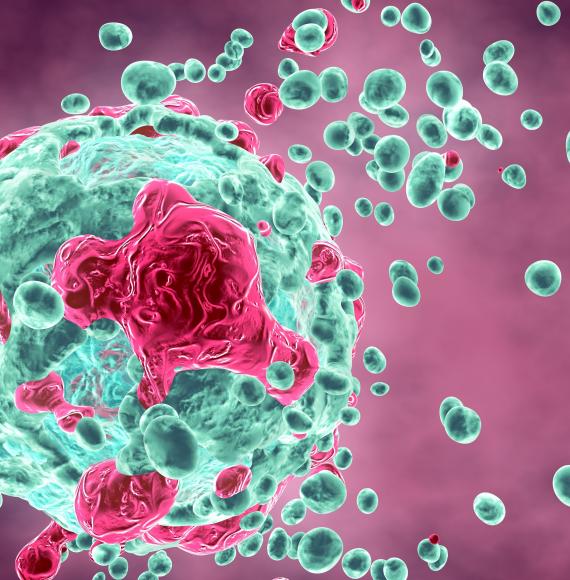 Artist impression of a breast cancer cell