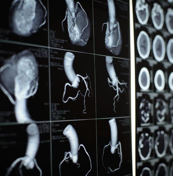 Cardiac CT scan