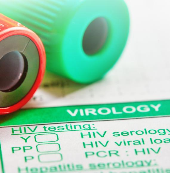 HIV testing 