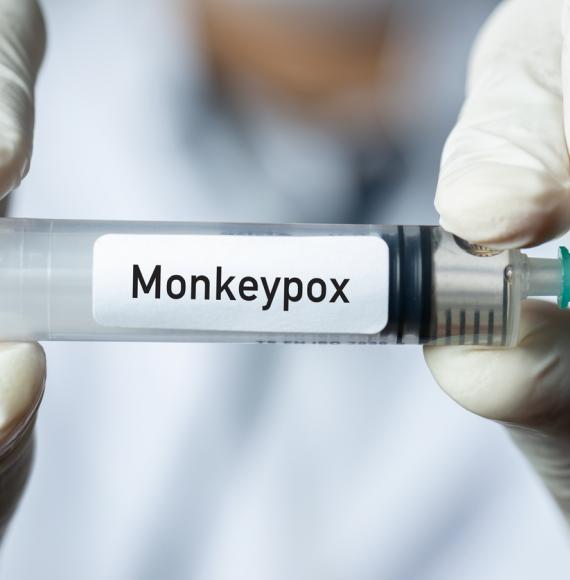 Monkeypox