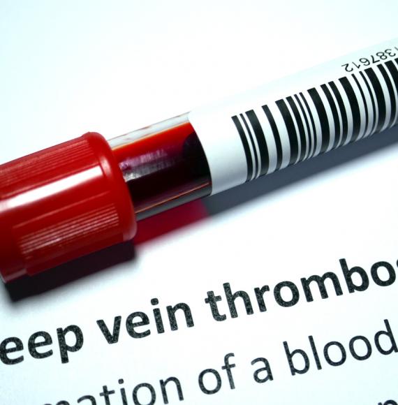 Thrombosis