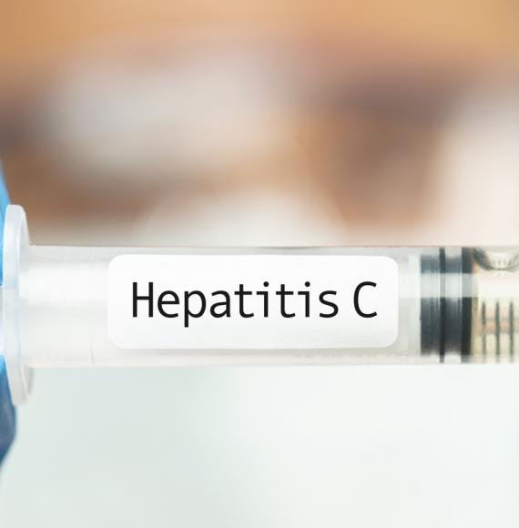 Hepatitis C