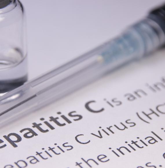 Hepatitis C